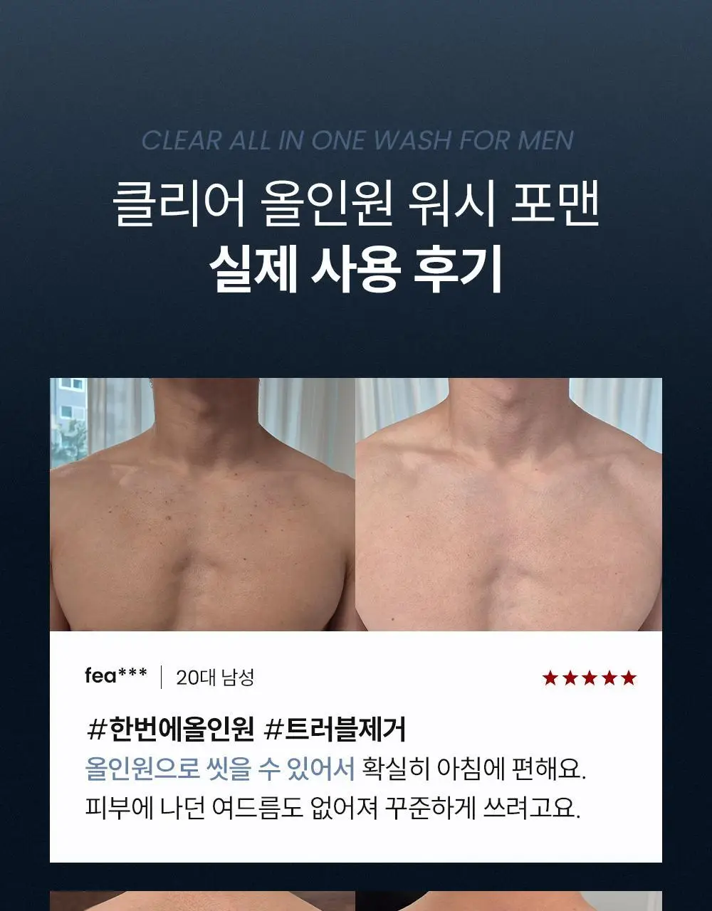[등드름/체취케어] 낫포유 지성피부전용 등드름/가드름 클리어 올인원 바디워시 포맨 500ml 상세페이지 15